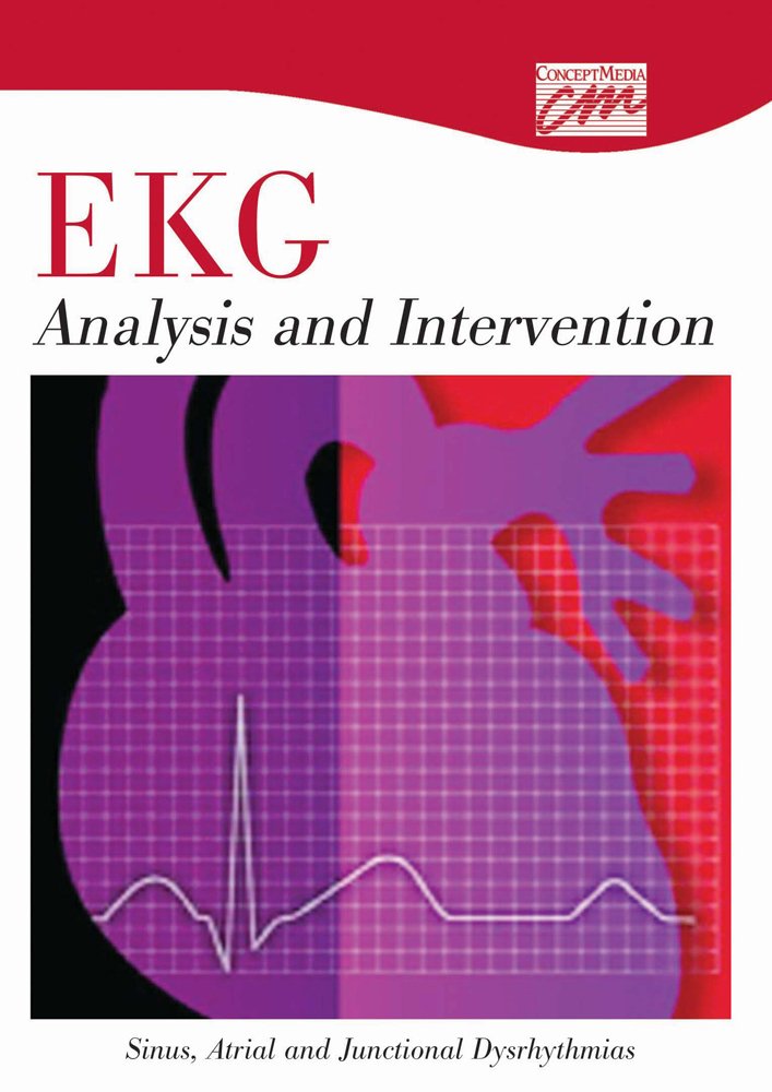 EKG Analysis and Intervention: Sinus, Atrial, and Junctional ... EKG Analysis and Intervention: Sinus, Atrial, and Junctional ...