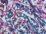 Avian Influenza H5N1 Strain Virus Chicken Fowl Photographic Poster Print, 32x24