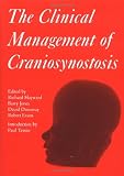 Clinical Management of Craniosynostosis