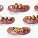 Billy Bob Teeth