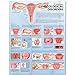 Common Gynecological Disorders Anatomical Chart