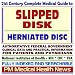 21st Century Complete Medical Guide to Slipped Disk. Herniated Disc 21st Century Complete Medical Guide to Slipped Disk. Herniated Disc