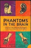 Phantoms in the Brain