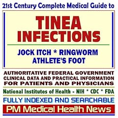 21st Century Complete Medical Guide to Tinea Infections, Jock Itch, Ringworm, and Athlete�s Foot, Authoritative Government Documents, Clinical References, and Practical Information for Patients and Physicians