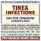 21st Century Complete Medical Guide to Tinea Infections, Jock Itch, Ringworm, and Athlete¿s Foot, Authoritative Government Documents, Clinical References, and Practical Information for Patients and Physicians