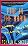 Fire in the Brain: Clinical Tales of Hallucination (Plume)