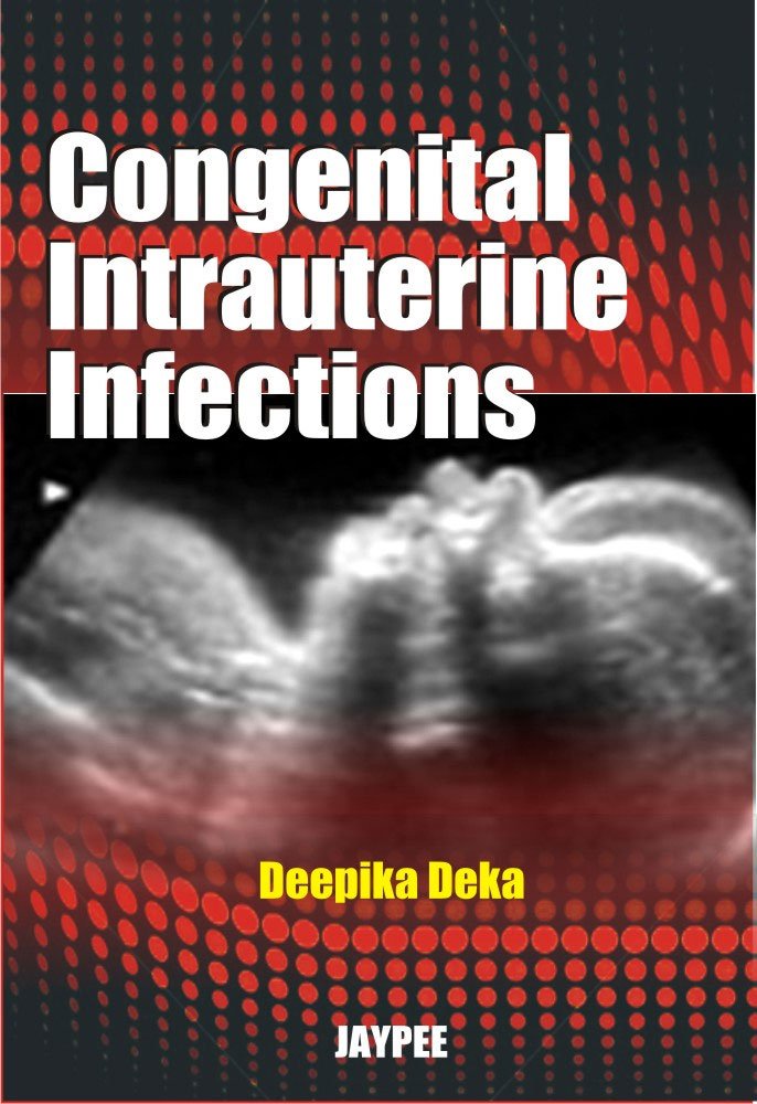 Congenital Intrauterine Infections: Deka: 9789350250327: Amazon ...