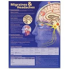 Migraines and Headaches Anatomical Chart