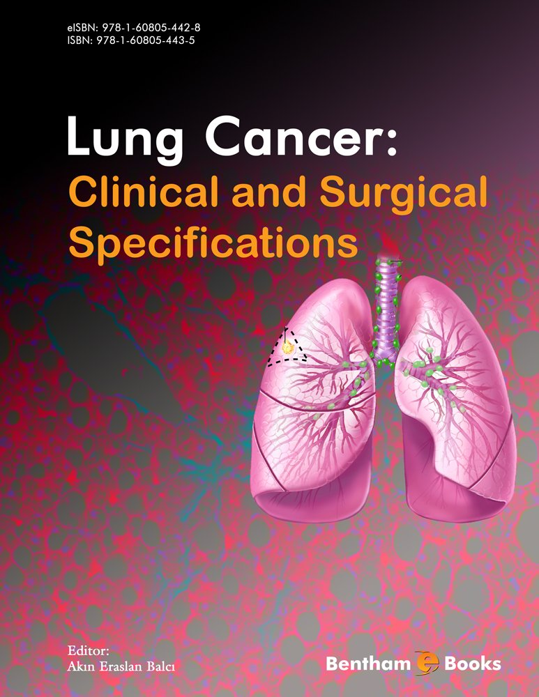 Lung Cancer: Clinical and Surgical Specifications - Kindle edition ...