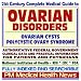 image 1 - 21st Century Complete Medical Guide to Ovarian Cysts