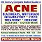 Find a Better Acne Treatment! Get (Clear Skin Today)