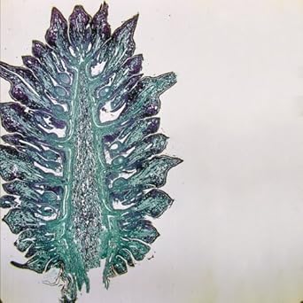 Amazon.com: Pine Young Ovulate Cone, l.s., 12 m Microscope Slide