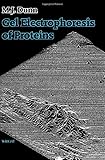 Gel electrophoresis of proteins