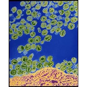 Photographic Prints of HIV viruses from Science Photo Library