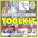 EhlersDanlos Syndrome