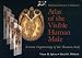 National Library of Medicine Atlas of the Visible Human Male: Reverse Engineering of the Human Body