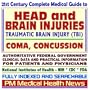 21st Century Complete Medical Guide to Head and Brain Injuries: Traumatic Brain Injury (TBI), Coma, Concussion--Authoritative Government Documents, ... Information for Patients and Physicians