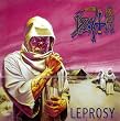 Leprosy