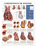 Lww Cardiovascular Disease 2nd Edition Anatomical Chart Laminated-9915PL1.5