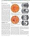 The Netter Collection of Medical Illustrations: The Endocrine System: Volume 2 (Netter Green Book Collection)