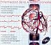 Books : Enfermedad de La Arteria Coronaria (Coronary Artery Disease, CD-ROM in Spanish)