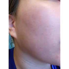 Olay Smooth Finish Facial Hair Removal Duo Fine To Medium Hair