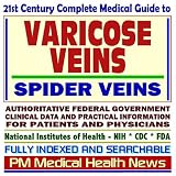 21st Century Complete Medical Guide to Varicose Veins and Spider Veins: Authoritative Government Documents, Clinical References, and Practical Information for Patients and Physicians
