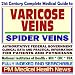 21st Century Complete Medical Guide to Varicose Veins and Spider Veins: Authoritative Government Documents, Clinical References, and Practical Information for Patients and Physicians