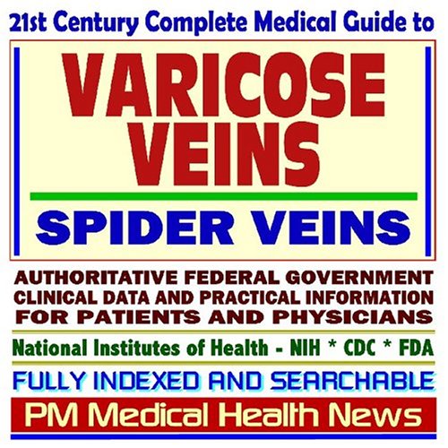 Varicose-Veins
