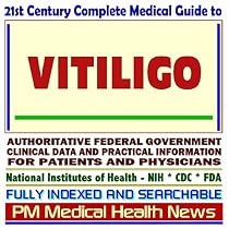 21st Century Complete Medical Guide to Vitiligo: Authoritative Government Documents, Clinical References, and Practical Information for Patients and Physicians