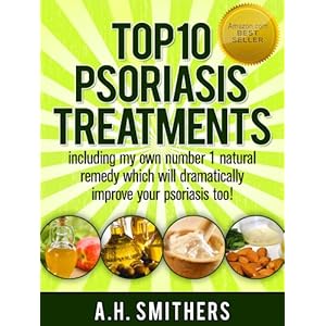 Top 10 treatments for psoriasis