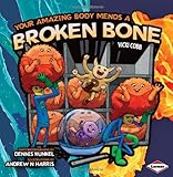 Your amazing body mends a broken bone