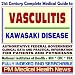 21st Century Complete Medical Guide to Vasculitis, Kawasaki Disease: Authoritative Government Documents, Clinical References, and Practical Information for Patients and Physicians