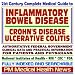 21st Century Complete Medical Guide to Inflammatory Bowel Disease, Crohn¿s Disease, Ulcerative Colitis, Authoritative Government Documents, Clinical References, and Practical Information for Patients and Physicians (CD-ROM)