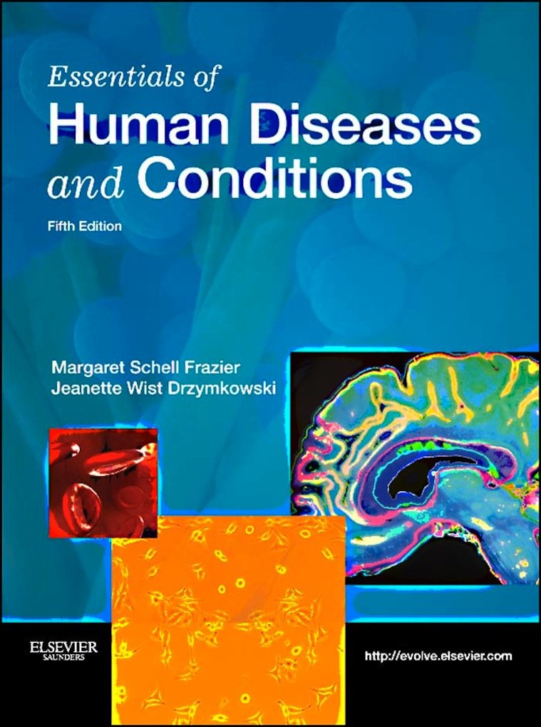 Amazon.com: Essentials of Human Diseases and Conditions eBook ...