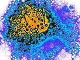 Hepatitis B Virus Photographic Poster Print, 30x40