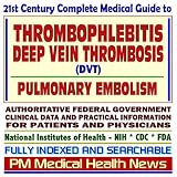 21st Century Complete Medical Guide to Thrombophlebitis, Deep Vein Thrombosis (DVT), and Pulmonary Embolism, Authoritative Government Documents, Clinical ... Information for Patients and Physicians