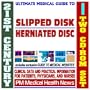 21st Century Ultimate Medical Guide to Slipped Disks (Herniated Discs) - Authoritative Clinical Information for Physicians and Patients (Two CD-ROM Set)