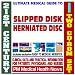 21st Century Ultimate Medical Guide to Slipped Disks (Herniated Discs) - Authoritativ...