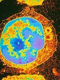 Lymphocyte from Peripheral Blood Tem X10,000 Enhanced Photographic Poster Print, 24x32