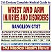 21st Century Complete Medical Guide to Wrist and Arm Injuries and Disorders, Ganglion Cyst: Authoritative Government Documents, Clinical References, and ... Information for Patients and Physicians