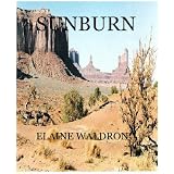 Sunburn