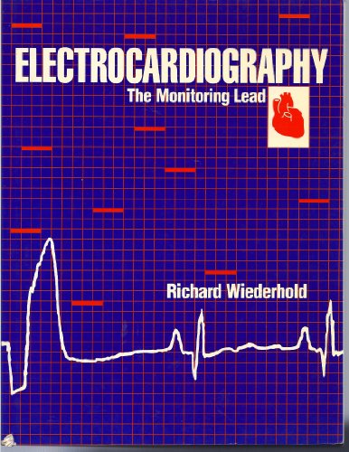 Electrocardiography: The Monitoring Lead