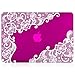 Kuzy - Lace Rubberized Hard Case for Older MacBook Pro 15.4 inch with Retina Display A1398 15 inch Plastic Shell Cover - Lace Raspberry