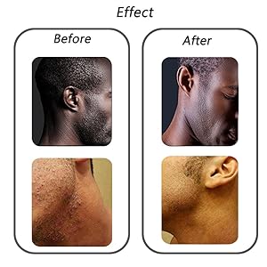 Exfoliating Brush Body Brush Eliminate Shaving Irritation For