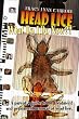 Head Lice... What Do I Do Now??