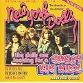 Great Big Kiss (Greatest Hits, Live)