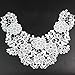 Yontree Venise Lace Applique