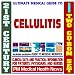 21st Century Ultimate Medical Guide to Cellulitis - Authoritative Clinical Information for Physicians and Patients (Two CD-ROM Set)