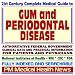 gum disease - 21st Century Complete Medical Guide to Gum Disease and Periodontal Disease, Authoritative Government Documents, Clinical References, and Practical Information for Patients and Physicians (CD-ROM)